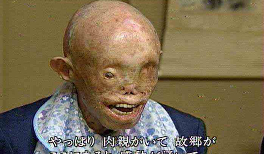 Forgotten Horrors: Ant-Walking Alligators of Hiroshima Forgotten Horrors